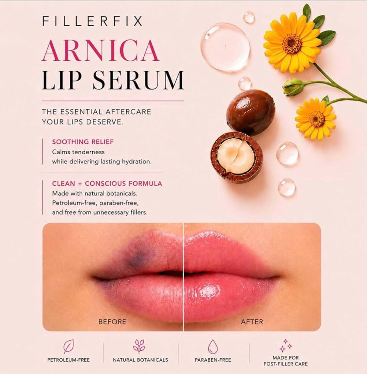 FillerFix – Lip Filler Aftercare Serum | Arnica Lip Care