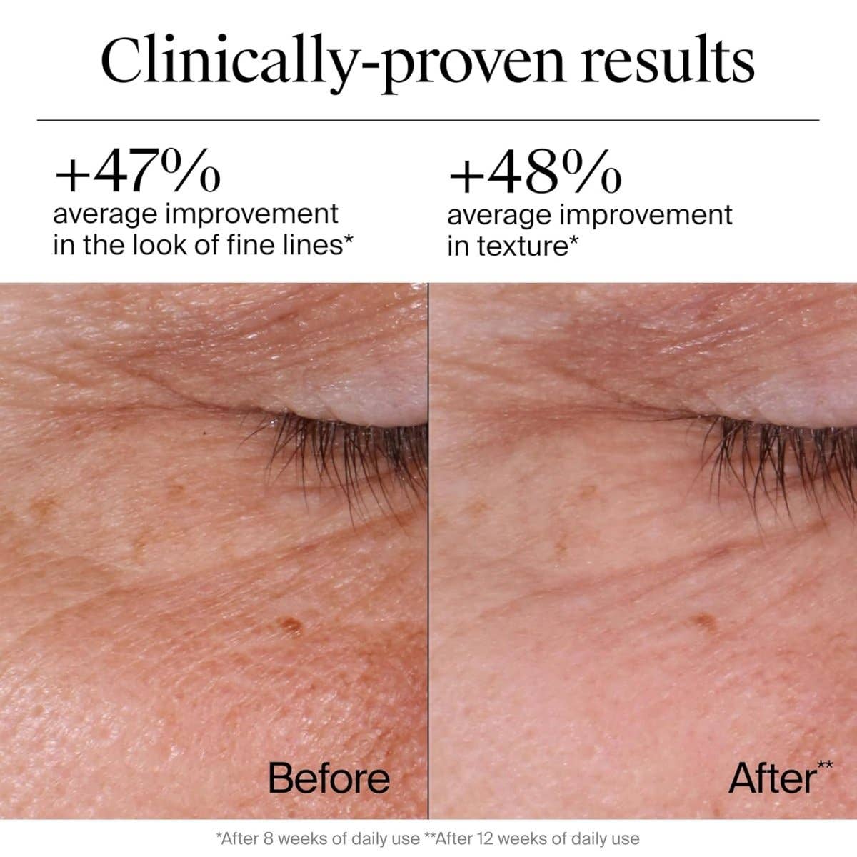 Retinol Overnight Wrinkle Repair Cream 50ml – Professional Anti-Aging Regenerating Treatment