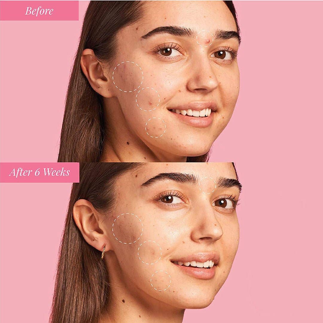 Glow & Protect Duo Niacinamide + Ceramide 2x30ml – Professional Brightening & Barrier Repair Combo
