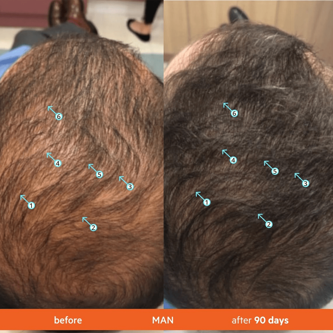 ReGROWTH Exosome Hair Serum 30 ml.