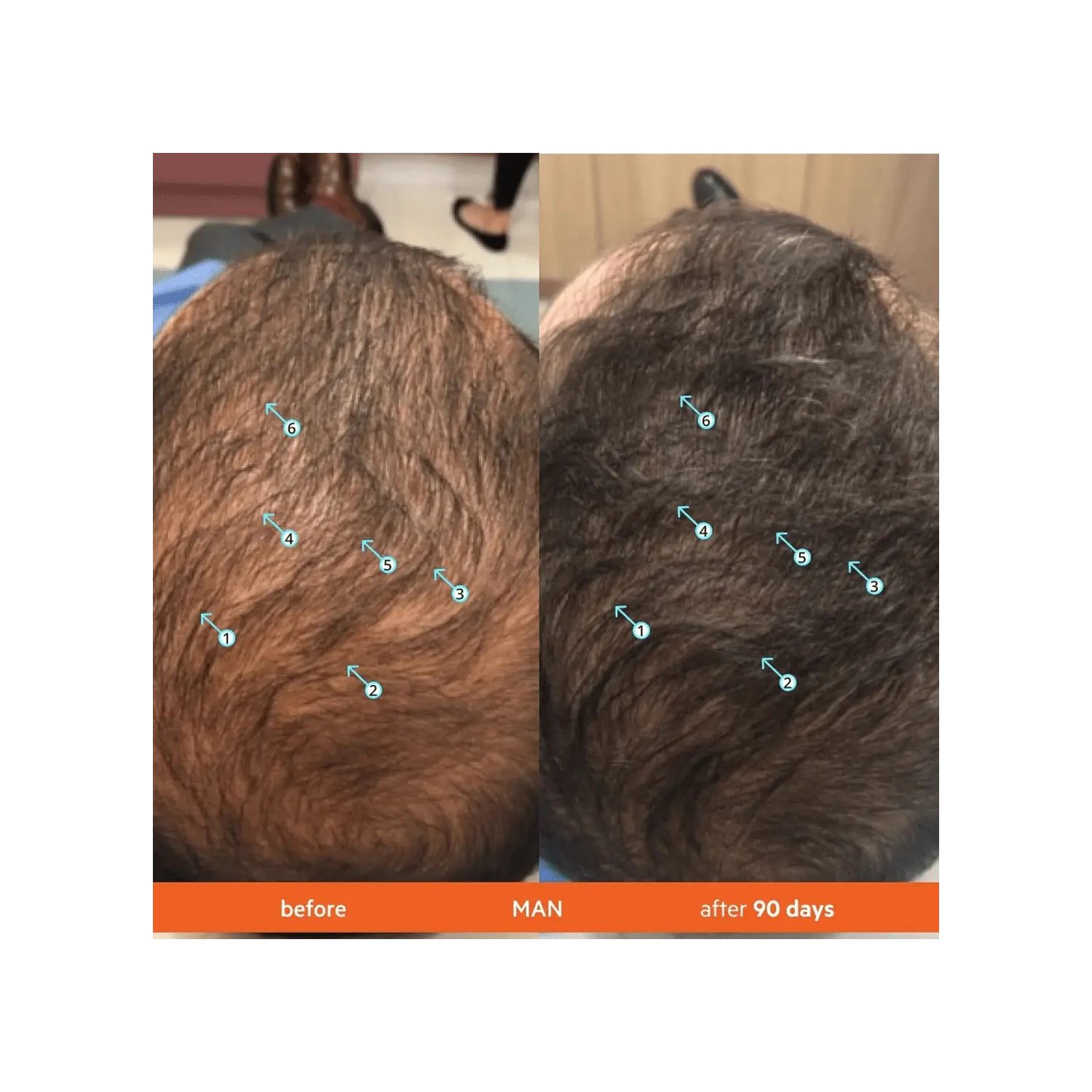 AMD Hair Growth Lotion – DHT Blocker & Follicle Stimulation Treatment