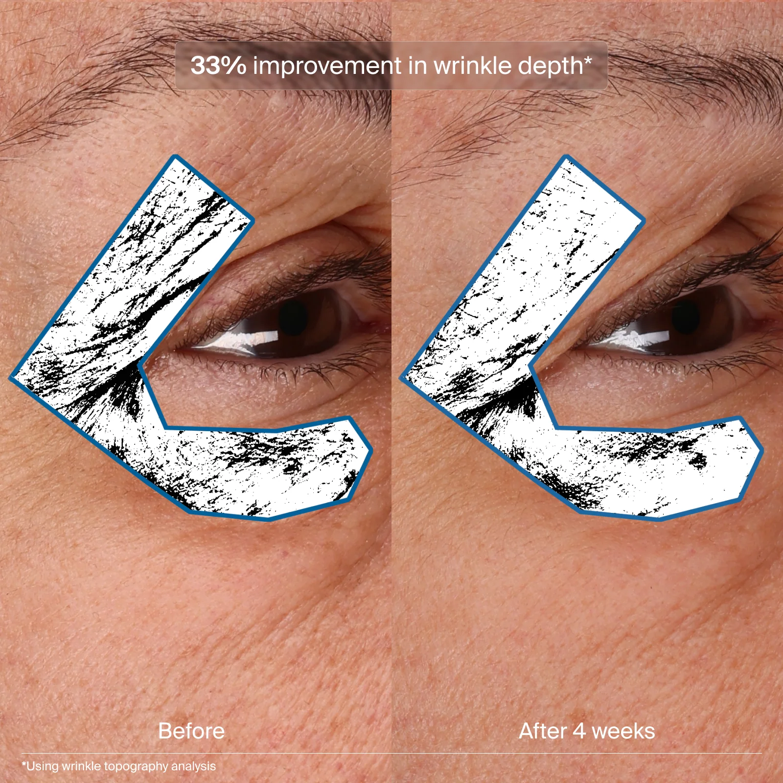 Pavise® Bioadaptive Stress Repair