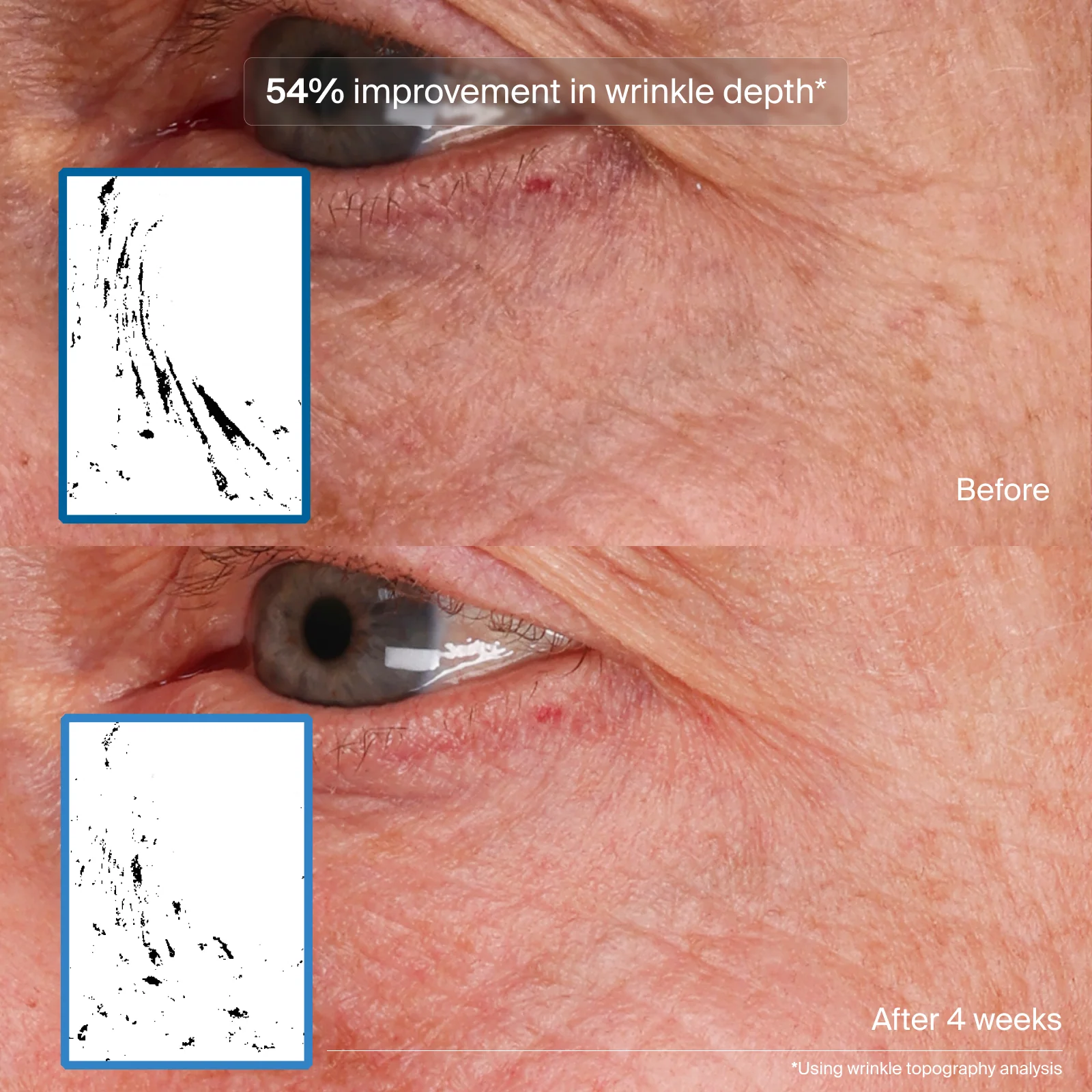 Pavise® Bioadaptive Stress Repair