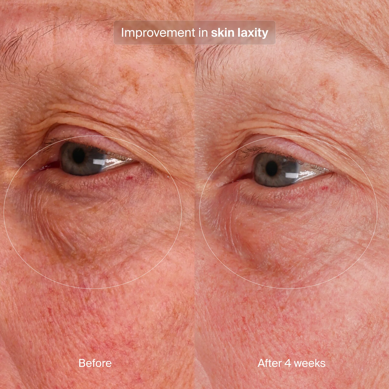 Pavise® Bioadaptive Stress Repair