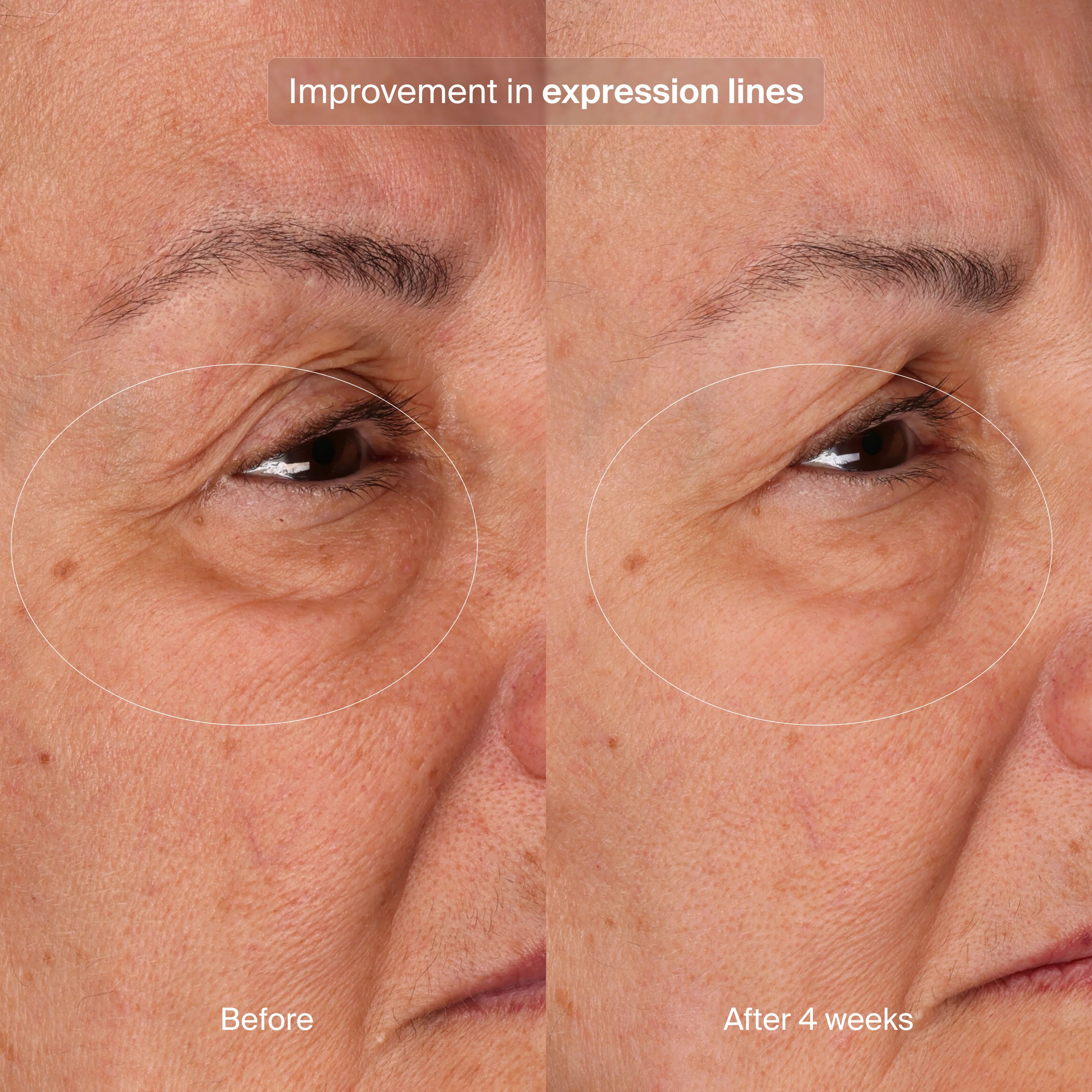 Pavise® Bioadaptive Stress Repair