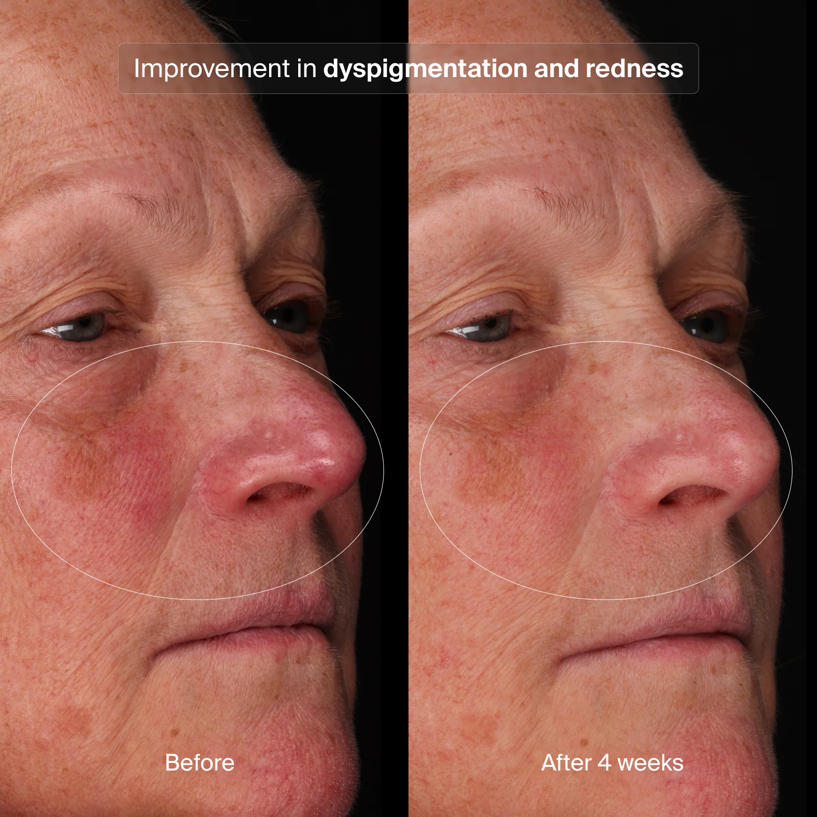 Pavise® Bioadaptive Stress Repair