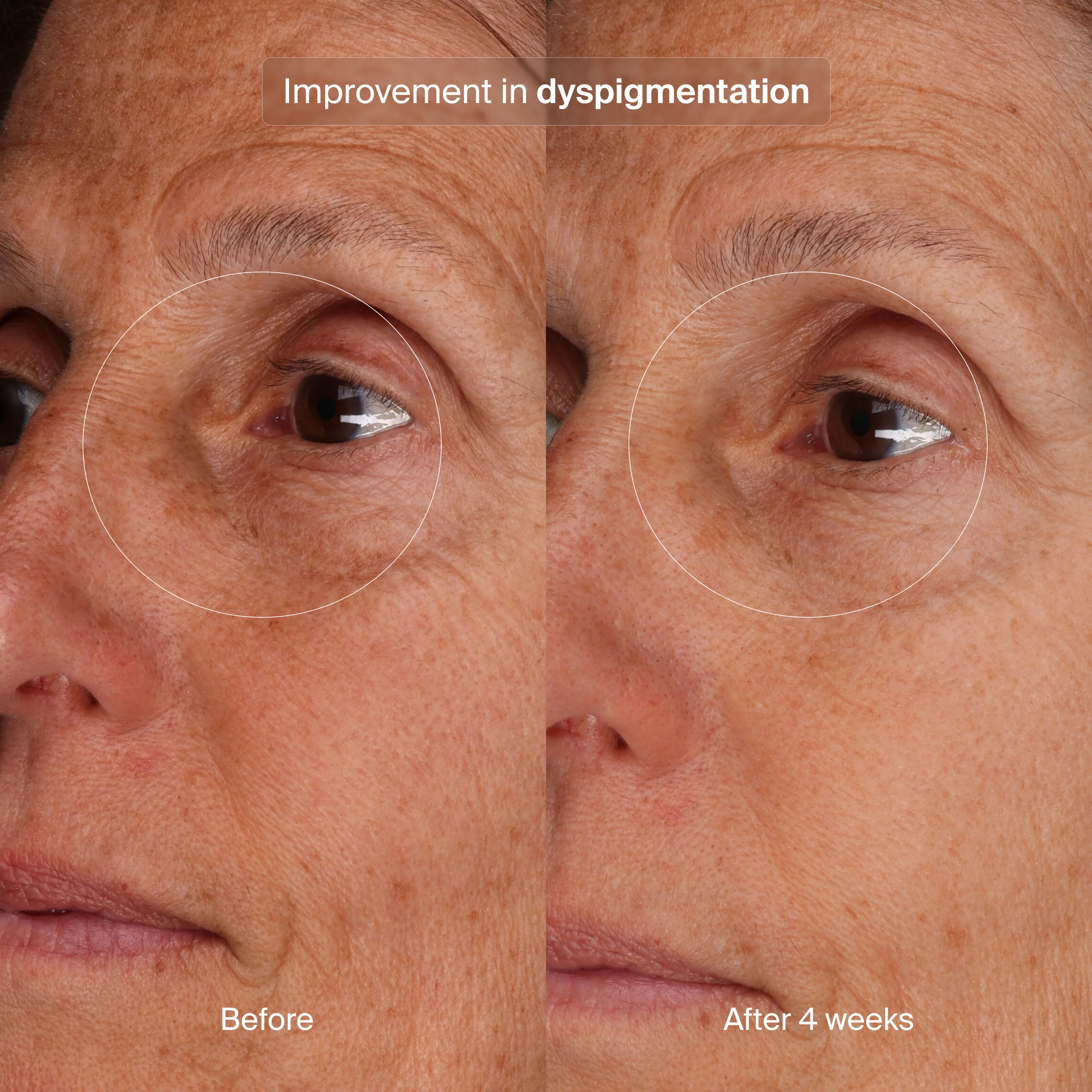 Pavise® Bioadaptive Stress Repair