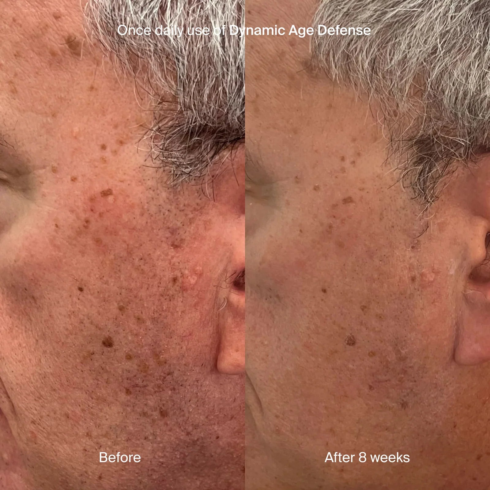 Pavise® Dynamic Age Defense SPF