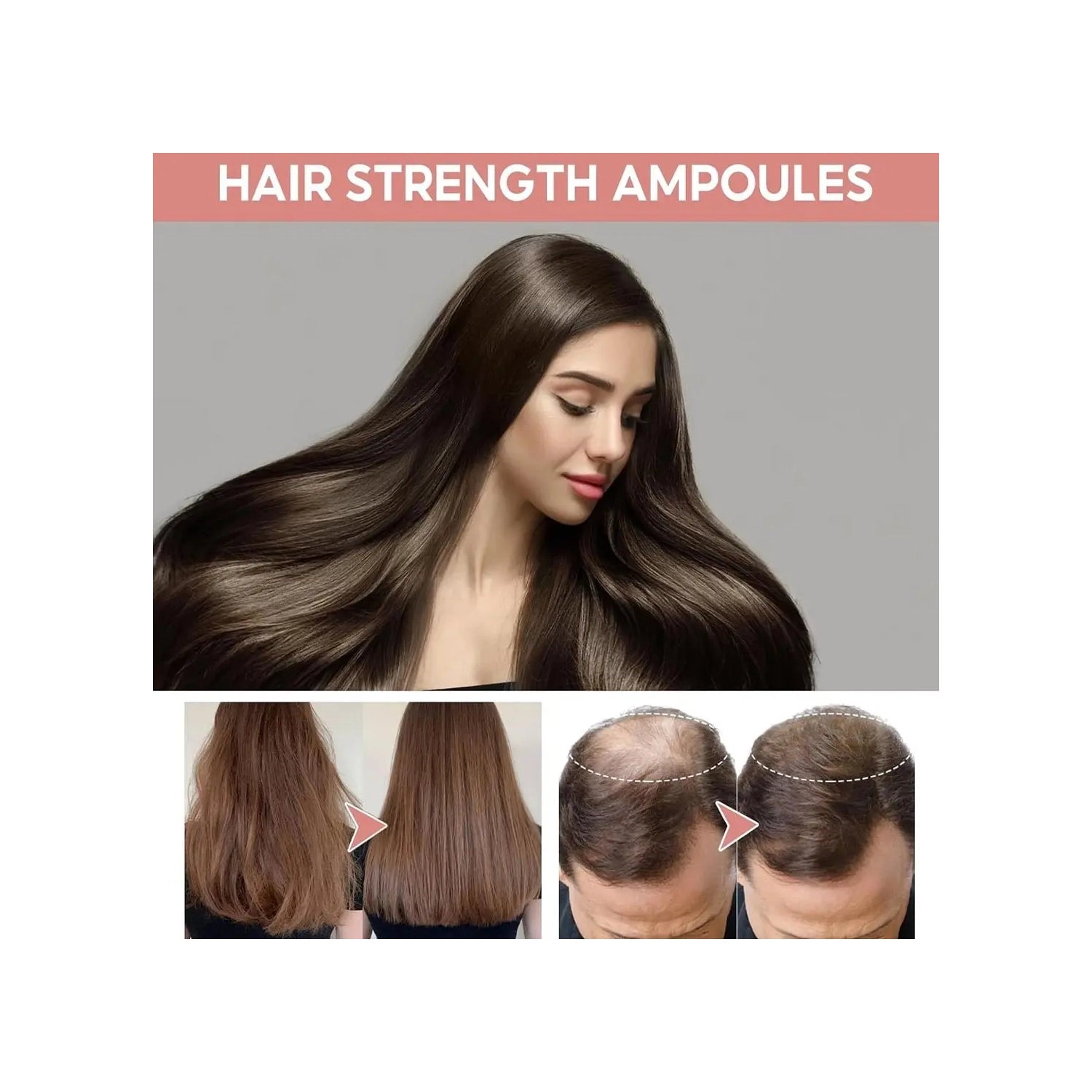 AMD Hair Growth Lotion – DHT Blocker & Follicle Stimulation Treatment